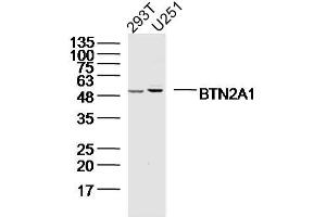 Lane 1: 293T; Lane 2: U251 cell lysates probed with BTN2A1 Polyclonal Antibody, Unconjugated (bs-20473R) at 1:300 overnight at 4˚C. (BTN2A1 Antikörper  (AA 101-200))