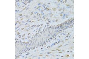 Immunohistochemistry of paraffin-embedded mouse esophagus using AIFM1 Antibody (ABIN5971393) at dilution of 1/200 (40x lens). (AIF Antikörper)