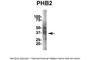 IP Suggested AntiPhb2 Antibody Positive Control: NT2 CELL/BRAIN TISSUE (Prohibitin 2 Antikörper  (Middle Region))
