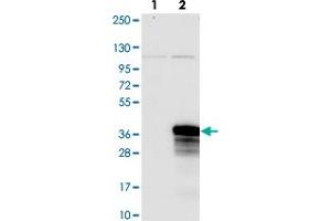 Western blot analysis of Lane 1: Negative control (vector only transfected HEK293T lysate). (NOPCHAP1 Antikörper)