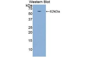 Detection of Recombinant CTSA, Dog using Polyclonal Antibody to Cathepsin A (CTSA) (CTSA Antikörper  (AA 234-494))