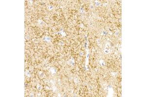 Immunohistochemistry of paraffin-embedded human brain using NgR3 Rabbit mAb (ABIN7269932) at dilution of 1:50 (40x lens). (RTN4RL1 Antikörper)