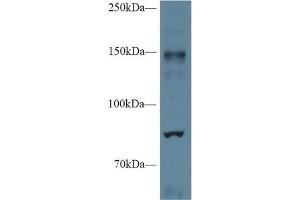 Western blot analysis of Mouse Cerebrum lysate, using Mouse NOS2 Antibody (1 µg/ml) and HRP-conjugated Goat Anti-Rabbit antibody (