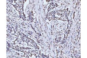 IHC analysis of 53BP1/TP53BP1 using anti-53BP1/TP53BP1 antibody (ABIN7599869). (TP53BP1 Antikörper  (AA 1239-1972))