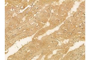 C2CD2 Mouse Monoclonal Antibody at 1/100 staining rat heart tissue by IHC-P. (C2CD2 Antikörper)