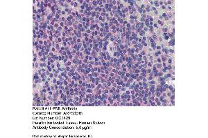 Immunohistochemistry (IHC) image for anti-Promyelocytic Leukemia (PML) (C-Term) antibody (ABIN2777721) (PML Antikörper  (C-Term))