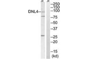 Western blot analysis of extracts from Jurkat cells, using DNL4 Antibody. (LIG4 Antikörper  (AA 591-640))