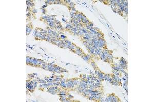 Immunohistochemistry (Paraffin-embedded Sections) (IHC (p)) image for anti-Cytochrome P450, Family 1, Subfamily A, Polypeptide 1 (CYP1A1) (AA 200-460) antibody (ABIN3023076)