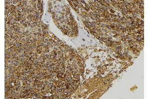 ABIN6273393 at 1/100 staining Human pancreas tissue by IHC-P. (CCL23 Antikörper)