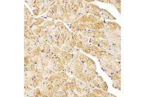 Immunohistochemistry of paraffin-embedded mouse heart using ACTN1 antibody at dilution of 1:100 (400x lens). (ACTN1 Antikörper)