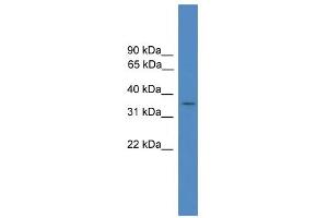 WB Suggested Anti-FLJ36070 Antibody Titration: 0. (FLJ36070 (Middle Region) Antikörper)