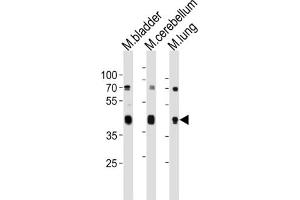 Western Blotting (WB) image for anti-Cholecystokinin A Receptor (CCKAR) antibody (ABIN3004717) (CCKAR Antikörper)