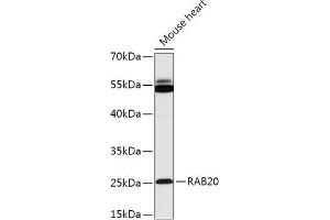Western blot analysis of extracts of Mouse heart, using R antibody (ABIN7269800) at 1:1000 dilution. (RAB20 Antikörper  (AA 80-190))