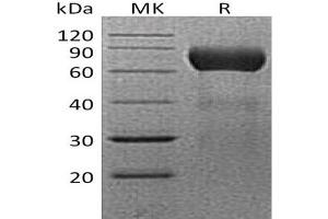 Western Blotting (WB) image for Ectonucleoside Triphosphate diphosphohydrolase 2 (ENTPD2) protein (His tag) (ABIN7320836)