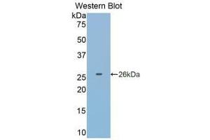 Detection of Recombinant GSTp, Human using Monoclonal Antibody to Glutathione S Transferase Pi (GSTp) (GSTP1 Antikörper  (AA 1-210))