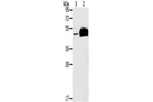 Western Blotting (WB) image for anti-Protein Tyrosine Phosphatase, Non-Receptor Type 20B (PTPN20B) antibody (ABIN2433645) (PTPN20 Antikörper)