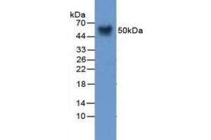 Detection of Vaspin in Mouse Skin Tissue using Polyclonal Antibody to Visceral Adipose Tissue Derived Serine Protease Inhibitor (Vaspin) (SERPINA12 Antikörper  (AA 71-148))