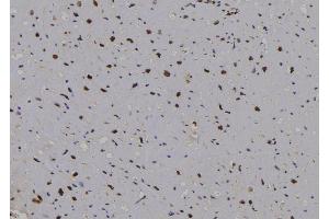 ABIN6276871 at 1/100 staining Human heart tissue by IHC-P.