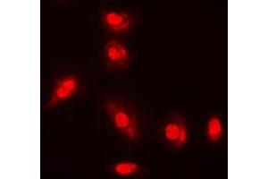 Immunofluorescent analysis of AKT (pY315) staining in A549 cells. (AKT1 Antikörper  (pTyr315))