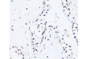 Immunohistochemistry (Paraffin-embedded Sections) (IHC (p)) image for anti-BRX1, Biogenesis of Ribosomes, Homolog (BRIX1) antibody (ABIN7257894)