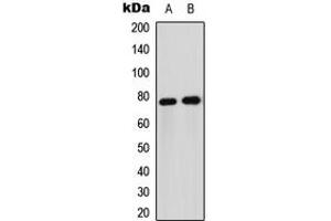 Western blot analysis of FOXO1 expression in Jurkat (A), HeLa (B) whole cell lysates. (FOXO1 Antikörper  (Center))