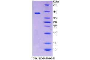 SDS-PAGE (SDS) image for Keratin 14 (KRT14) (AA 111-418) protein (His tag) (ABIN2125542)