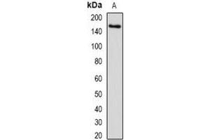 Western blot analysis of SETD5 expression in human liver (A) whole cell lysates. (SETD5 Antikörper)