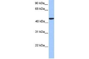 Human Lung; WB Suggested Anti-REXO4 Antibody Titration: 0. (REXO4 Antikörper  (Middle Region))