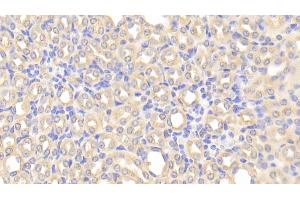 Immunohistochemistry (IHC) image for anti-Chordin-Like 1 (CHRDL1) (AA 272-447) antibody (ABIN7442435)