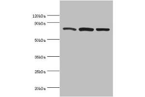 Western blot All lanes: Calpain-1 catalytic subunit antibody at 2 μg/mL Lane 1: A431 whole cell lysate Lane 2: Hela whole cell lysate Lane 3: Jurkat whole cell lysate Secondary Goat polyclonal to rabbit IgG at 1/10000 dilution Predicted band size: 82 kDa Observed band size: 82 kDa (CAPNL1 Antikörper  (Catalytic Subunit))