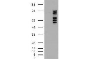 HEK293T cells were transfected with the pCMV6-ENTRY control (Left lane) or pCMV6-ENTRY MAPK6 (RC201597) (Right lane) cDNA for 48 hrs and lysed. (MAPK6 Antikörper  (AA 345-721))