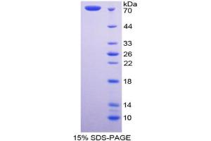SDS-PAGE analysis of Human Fibulin 4 Protein.