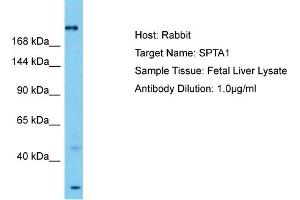 Host: Rabbit Target Name: SPTA1 Sample Tissue: Human Fetal Liver Antibody Dilution: 1ug/ml (SPTA1 Antikörper  (N-Term))