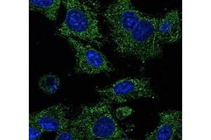Immunofluorescence (IF) image for anti-RAB25, Member RAS Oncogene Family (RAB25) (C-Term) antibody (ABIN1440003)