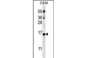 C Antibody (C-term) (ABIN656407 and ABIN2845701) western blot analysis in CEM cell line lysates (35 μg/lane). (CJ057 Antikörper  (C-Term))
