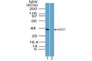 SOX1 Antikörper  (AA 100-150)