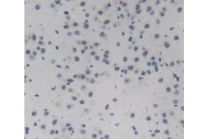 Used in DAB staining on fromalin fixed paraffin- embedded Kidney tissue (NUP214 Antikörper  (AA 601-868))