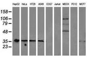 Image no. 11 for anti-Nonhomologous End-Joining Factor 1 (NHEJ1) antibody (ABIN1499729) (NHEJ1 Antikörper)