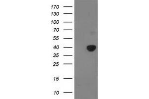 Image no. 1 for anti-Pyruvate Dehydrogenase (Lipoamide) alpha 1 (PDHA1) antibody (ABIN1500104) (PDHA1 Antikörper)