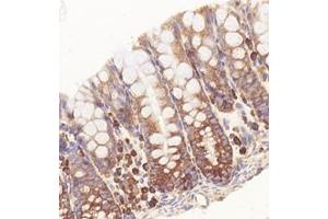 Immunohistochemistry (Paraffin-embedded Sections) (IHC (p)) image for anti-Ribosomal Protein L10 (RPL10) antibody (ABIN7075428)