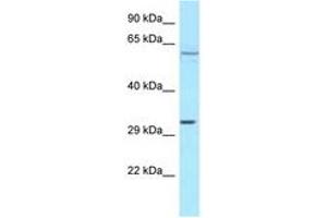 Image no. 1 for anti-Transforming Growth Factor beta Regulator 4 (TBRG4) (AA 323-372) antibody (ABIN6747963)