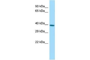Western Blotting (WB) image for anti-Protein Geranylgeranyltransferase Type I, beta Subunit (PGGT1B) (C-Term) antibody (ABIN2783452)