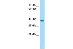 Host:  Rabbit  Target Name:  Pggt1b  Sample Type:  Rat Small Intestine lysates  Antibody Dilution:  1. (PGGT1B Antikörper  (C-Term))