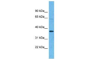 Western Blotting (WB) image for anti-Olfactory Receptor, Family 5, Subfamily H, Member 15 (OR5H15) (C-Term) antibody (ABIN2791757) (OR5H15 Antikörper  (C-Term))