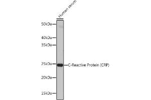 Western blot analysis of extracts of Human serum, using C-Reactive Protein (C-Reactive Protein (CRP)) antibody (ABIN7265972) at 1:1000 dilution. (CRP Antikörper)