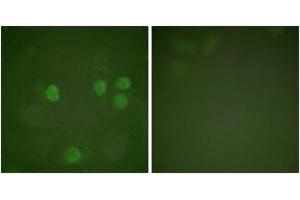 Immunofluorescence (IF) image for anti-Cyclin B1 (CCNB1) (AA 91-140) antibody (ABIN2888597) (Cyclin B1 Antikörper  (AA 91-140))