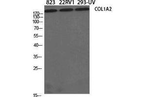 Western Blotting (WB) image for anti-Collagen, Type I, alpha 2 (COL1A2) (N-Term) antibody (ABIN3184006) (COL1A2 Antikörper  (N-Term))