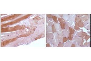 Immunohistochemistry (IHC) image for anti-Myoglobin (MB) antibody (ABIN1108360) (Myoglobin Antikörper)