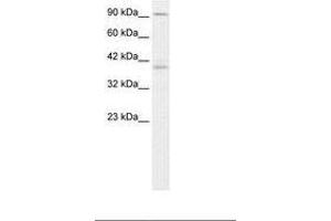 Image no. 2 for anti-Kinesin Family Member C2 (KIFC2) (AA 150-199) antibody (ABIN202931)