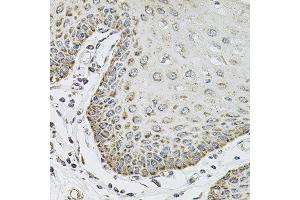 Immunohistochemistry of paraffin-embedded human esophagus using SDC2 antibody at dilution of 1:100 (x40 lens). (Syndecan 2 Antikörper)